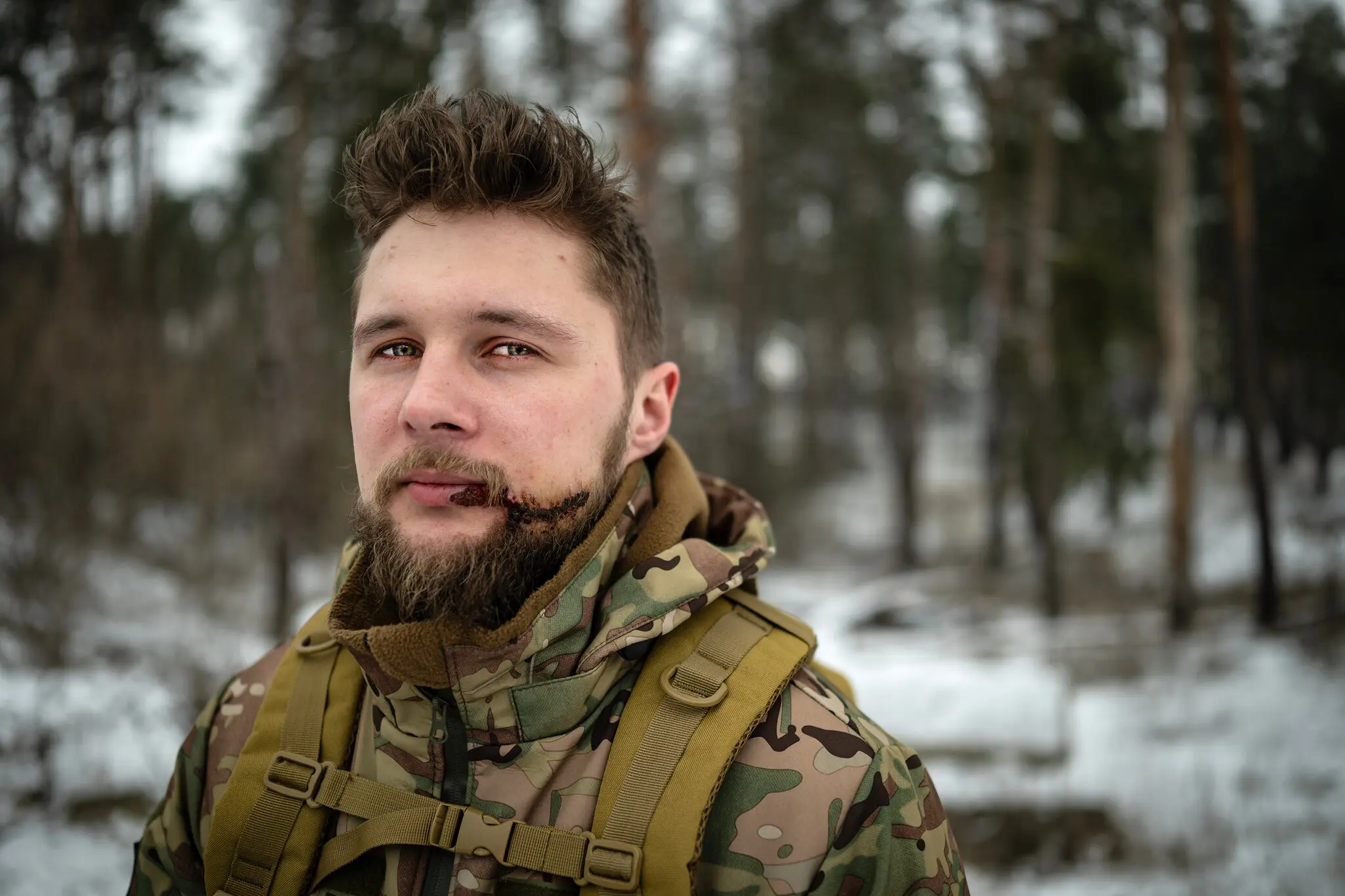 Віктор Біляк отримав осколкове поранення під час бою в Авдіївці.